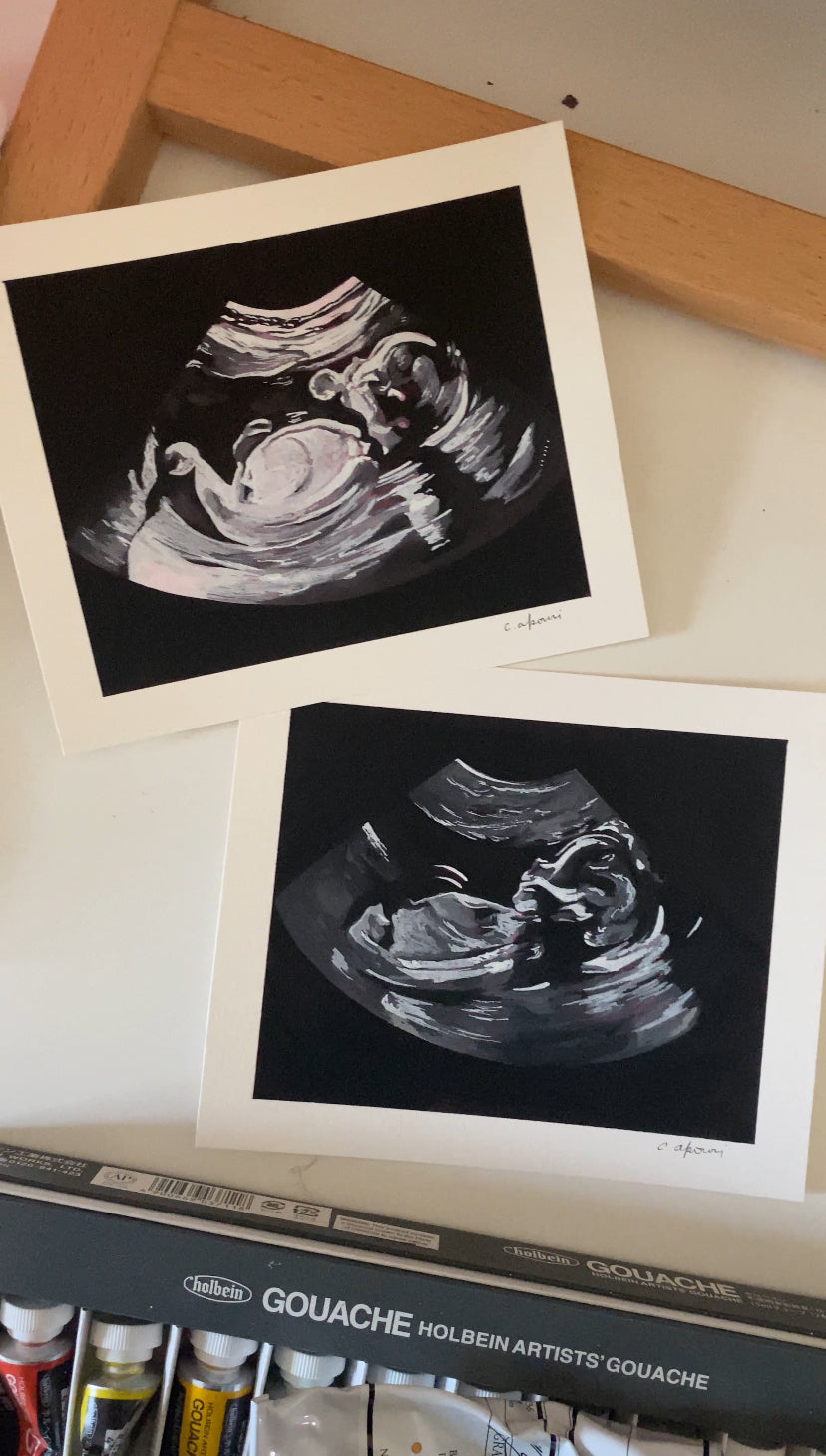 Custom Ultrasound Painting